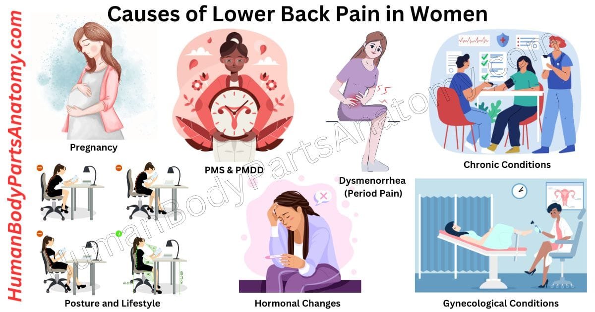 Lower back pain in women causes, symptoms, risks, and treatment tips illustration
