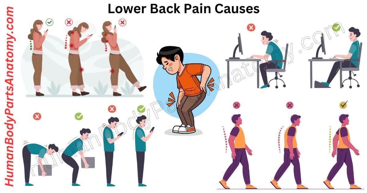 Illustration showing lower back pain causes and symptoms including muscle strain, poor posture, herniated disc, and risk factors like age and lifestyle.