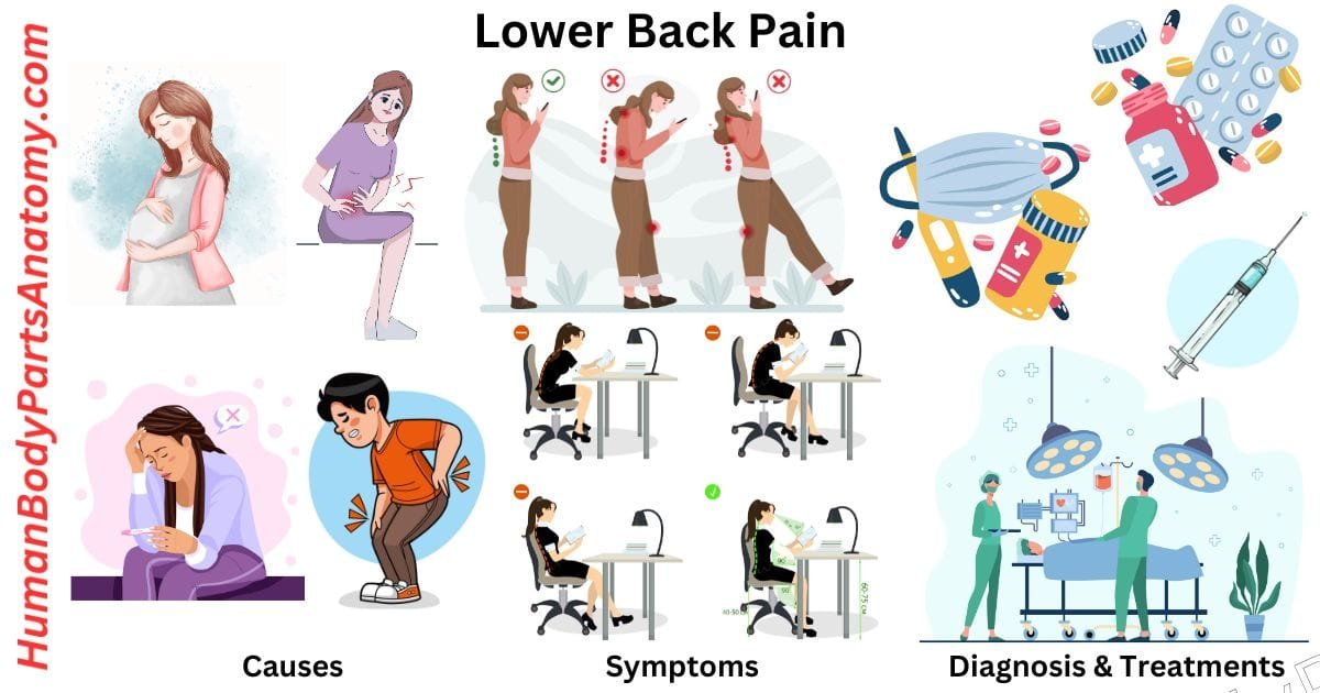 Lower back pain illustration showing causes, symptoms, and treatment options including poor posture, spinal issues, diagnosis tests, and exercises.